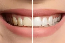 25632 purple whitening products