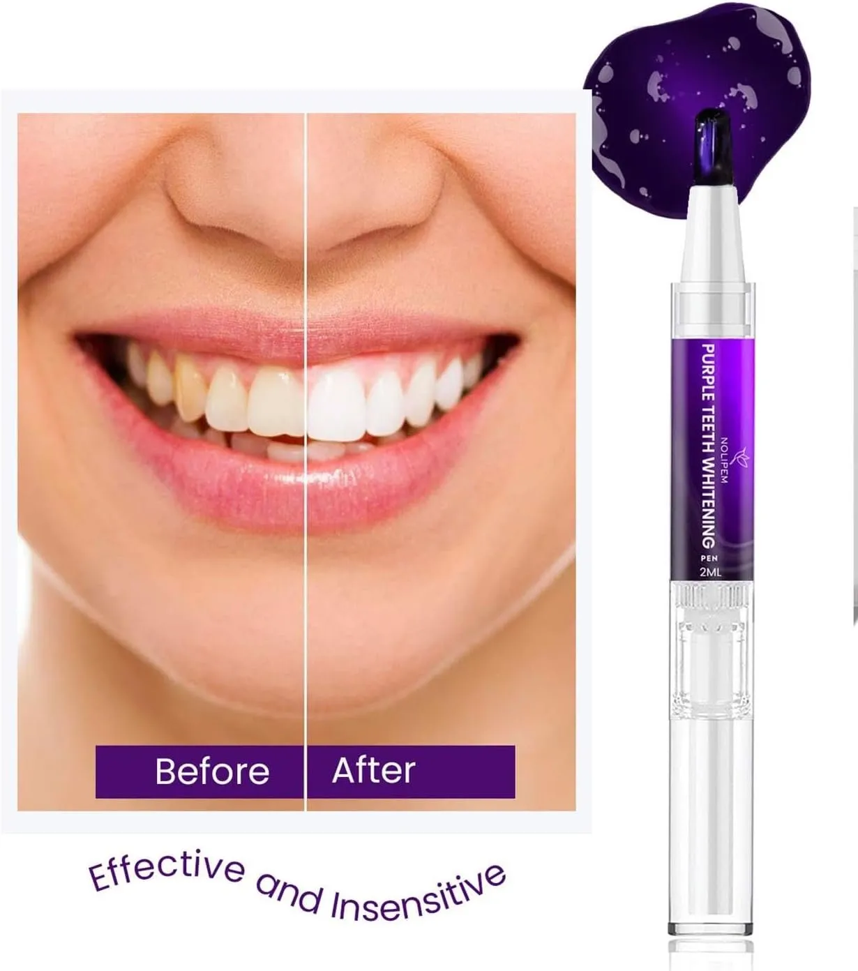 25632 purple whitening results