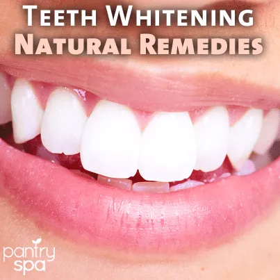 25634 teeth whitening before after