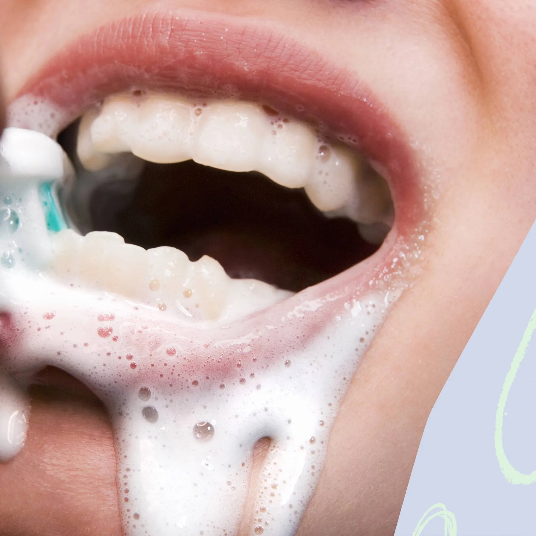 25634 teeth whitening overview