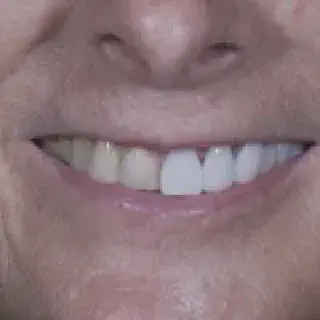 /img/25635-tijuana-dental-tourism.webp