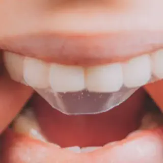 /img/25638-teeth-whitening-tips.webp