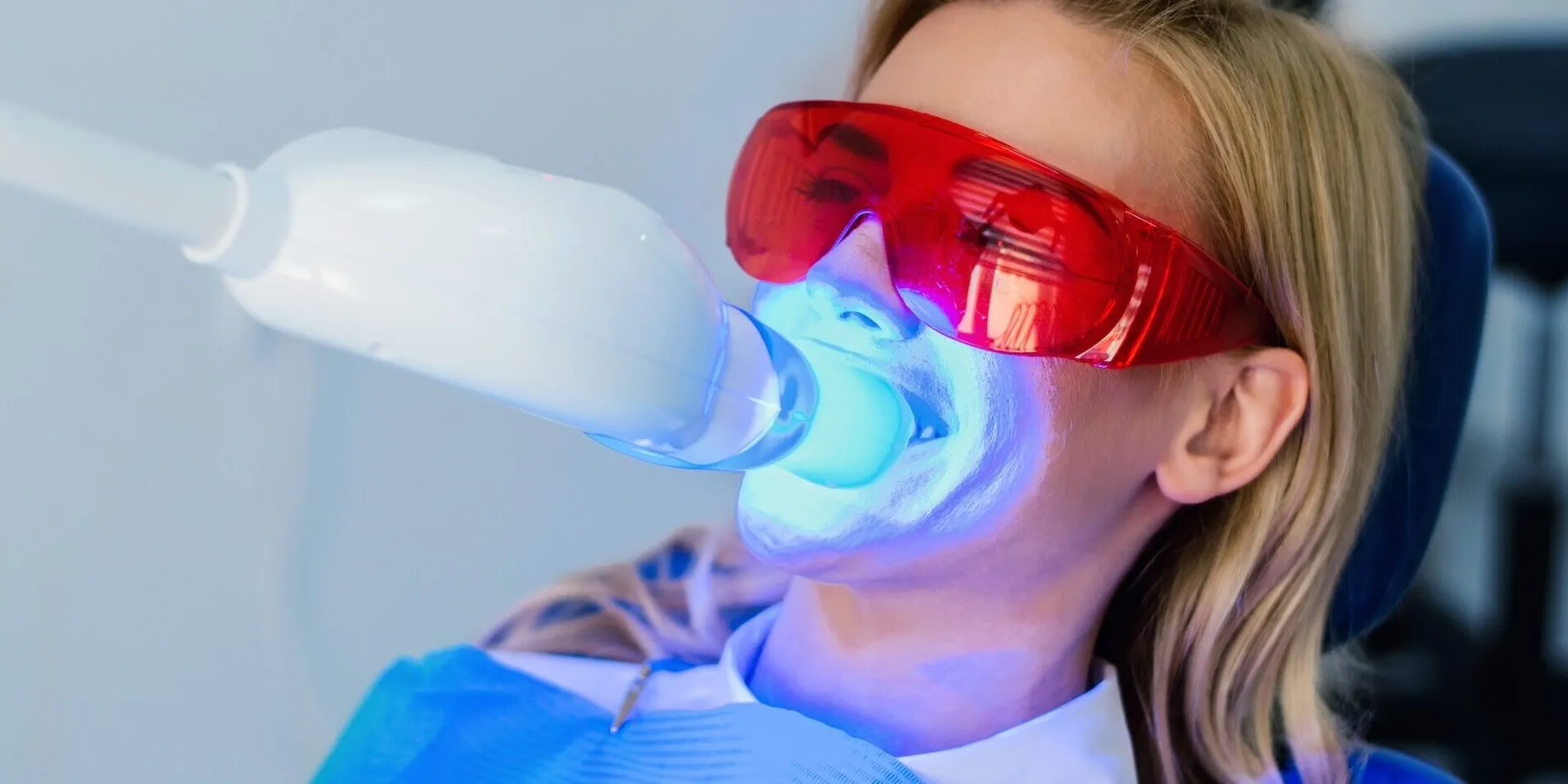 25640 teeth whitening process