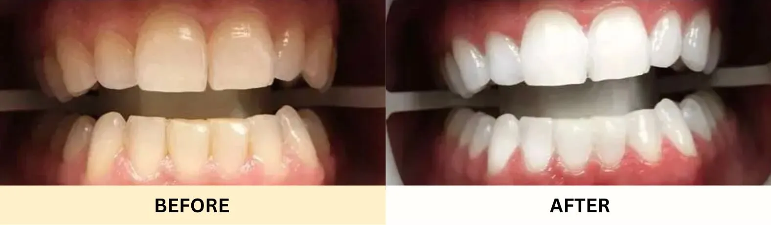 25640 teeth whitening thousand oaks ca