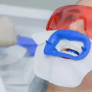 /img/25643-sensitive-teeth-whitening-7.webp
