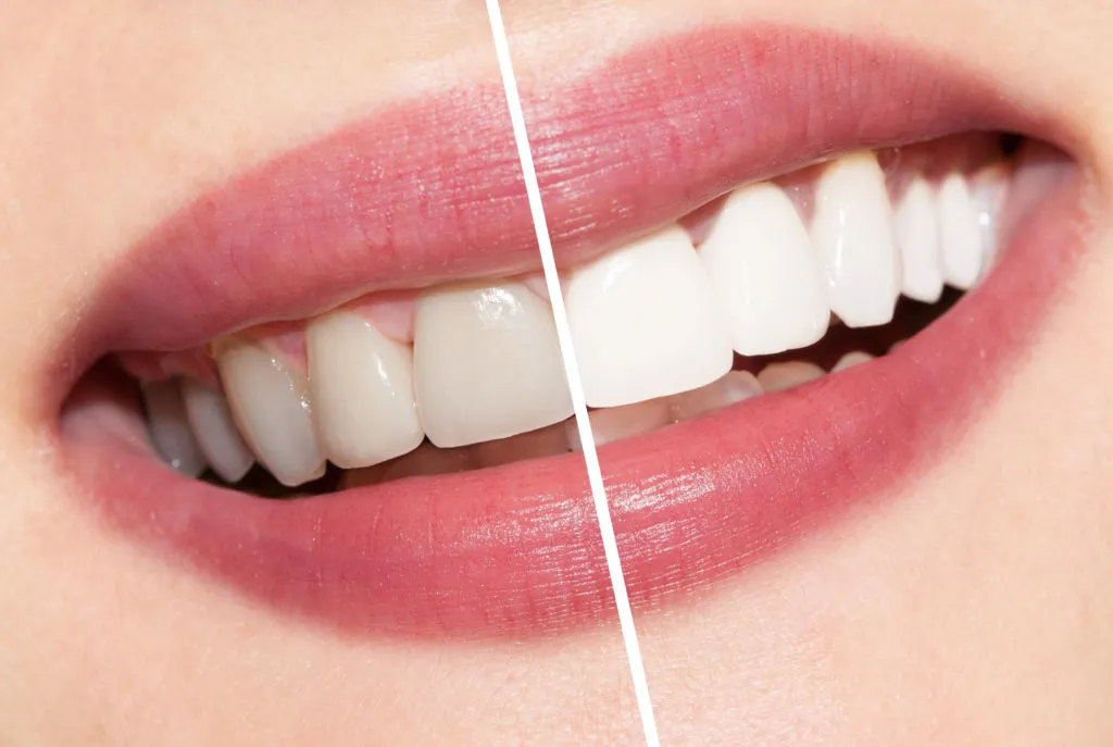 /img/25646-dental-checkups.webp