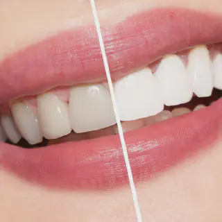 /img/25646-dental-checkups.webp