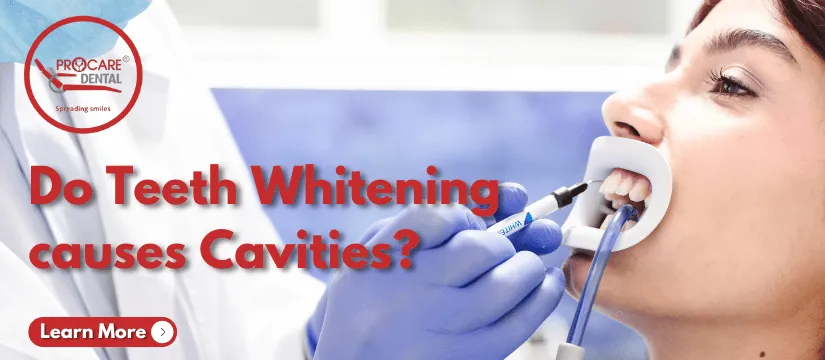 25646 teeth whitening products