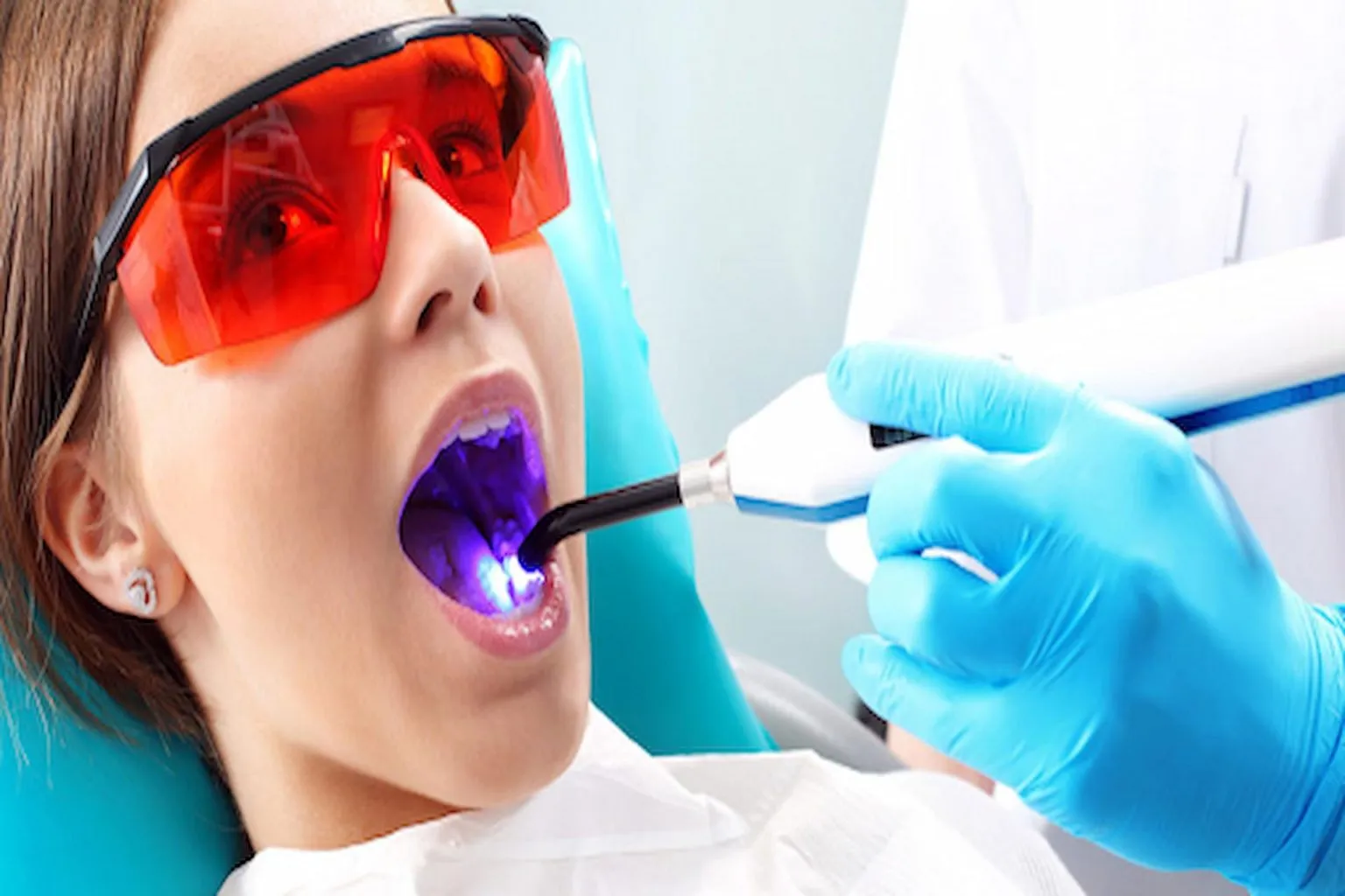 /img/25647-over-the-counter-whitening.webp