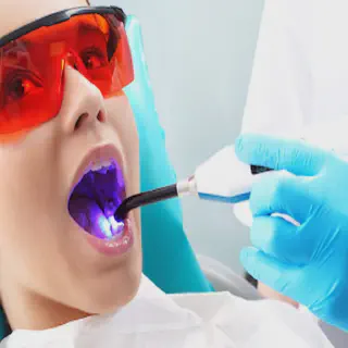 /img/25647-over-the-counter-whitening.webp