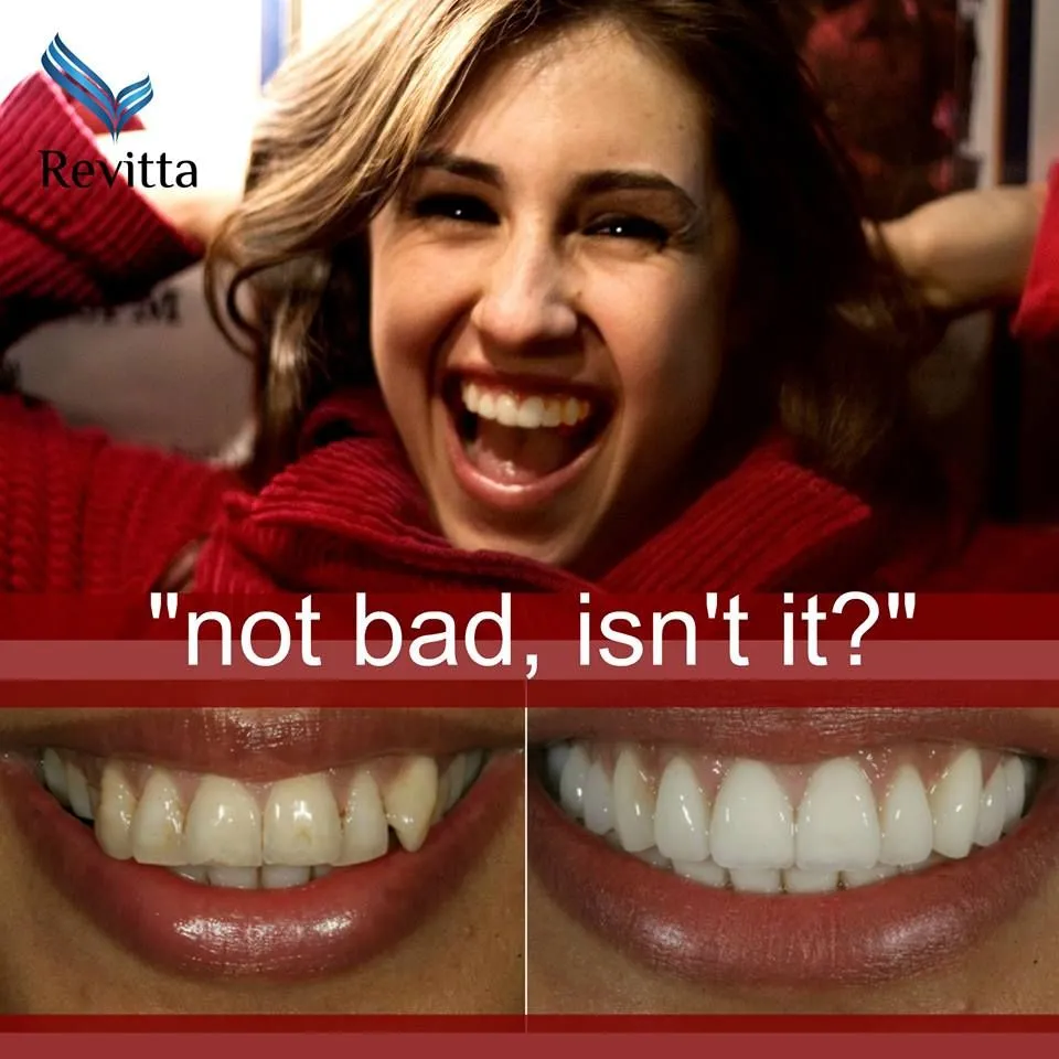 25648 alternative teeth whitening