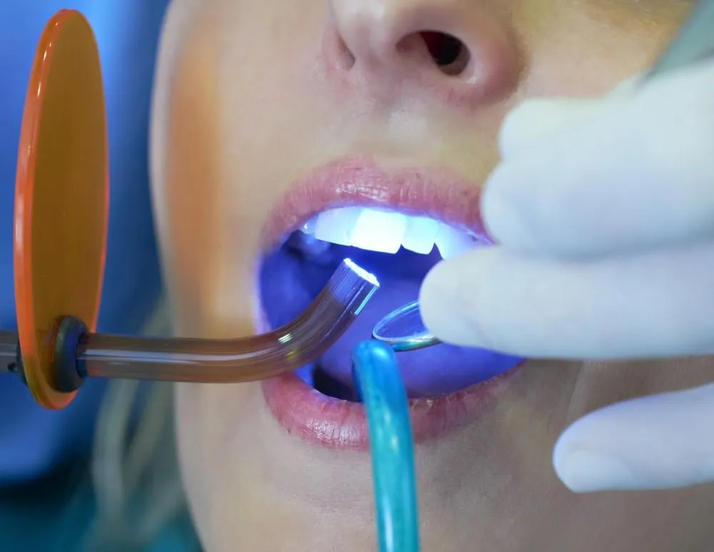 25649 white diet after teeth whitening image4