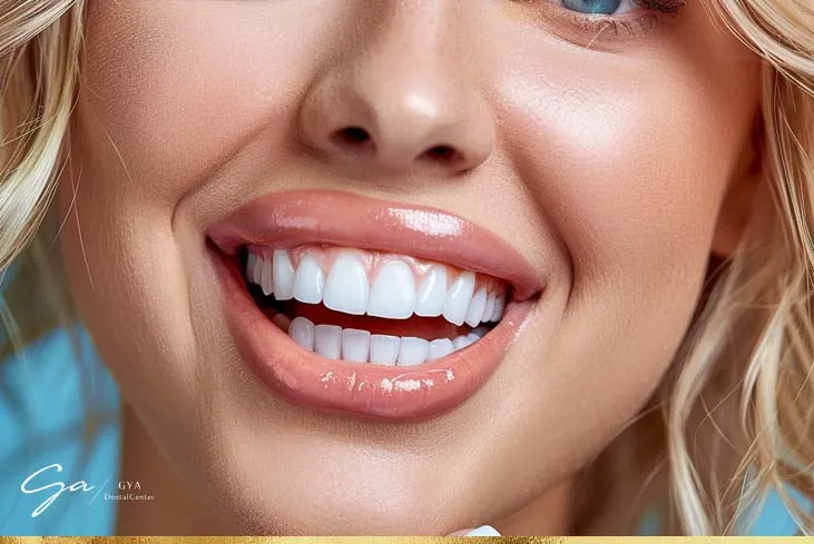 25649 white diet after teeth whitening image5
