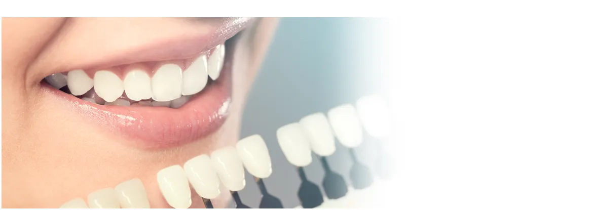 /img/25650-teeth-whitening-durham-uk-aftercare.webp