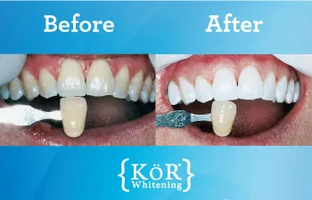 25651 reputable dentist fort lauderdale