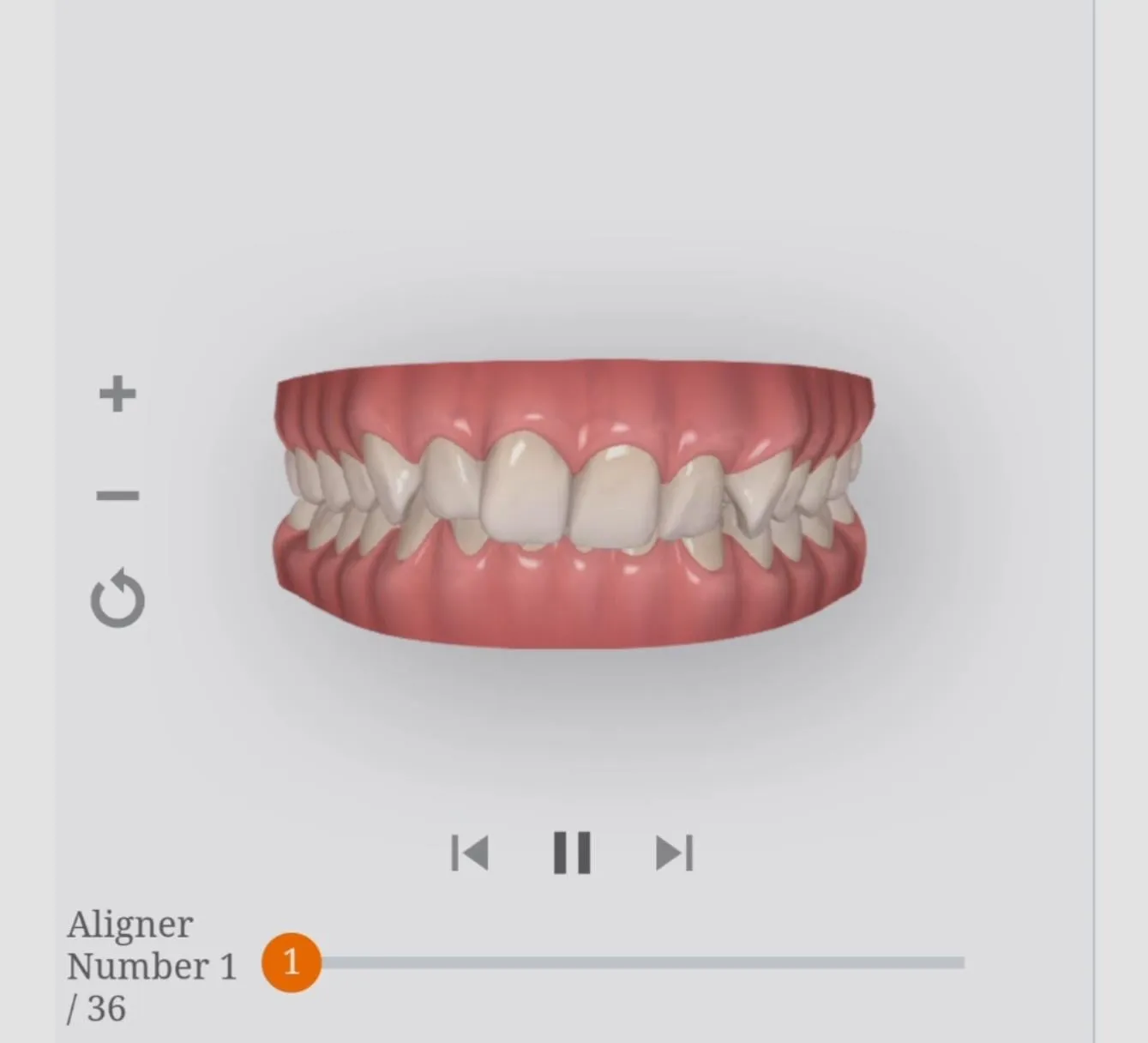 25655 brushing and flossing