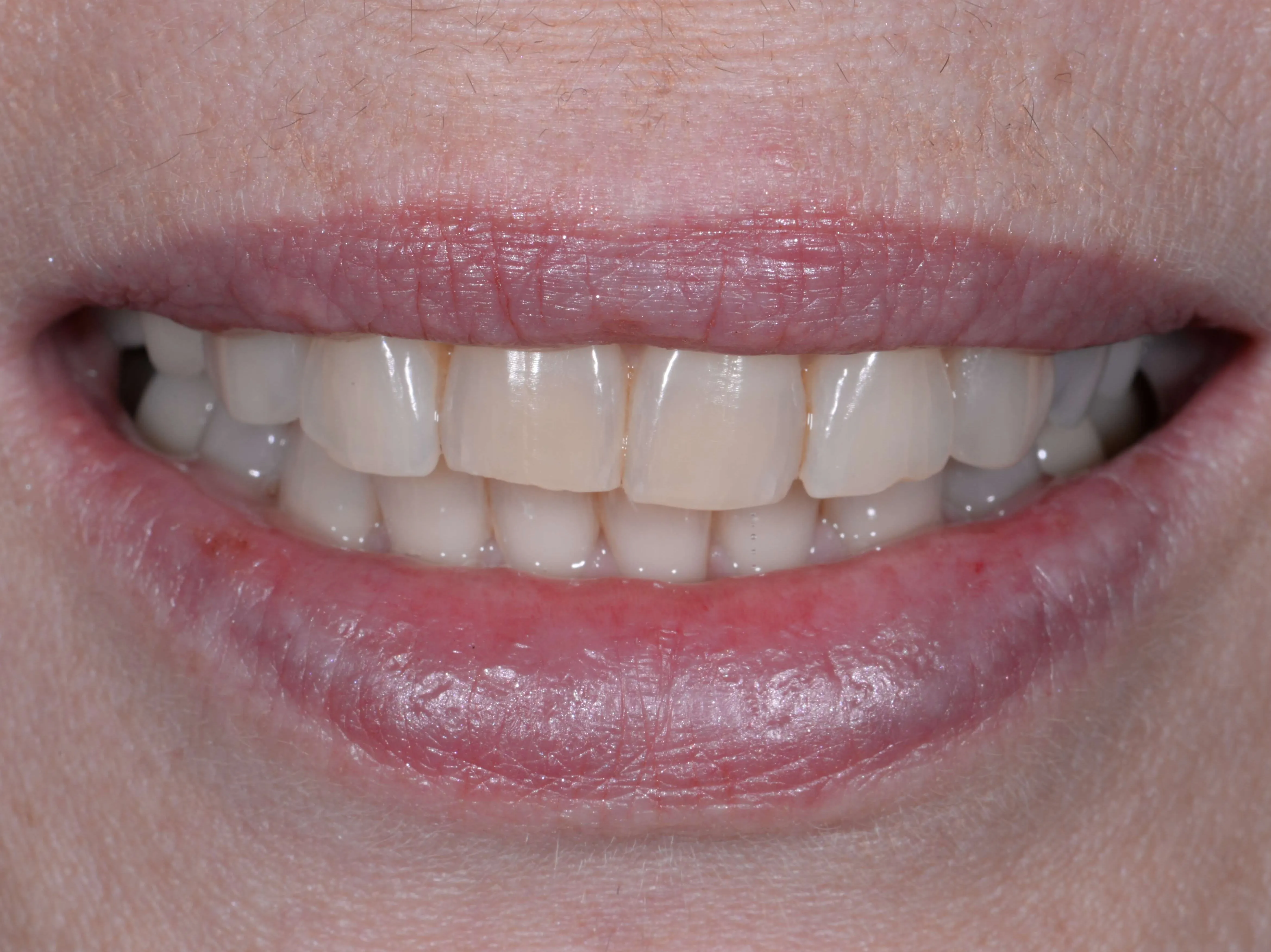 25655 dentist consultation