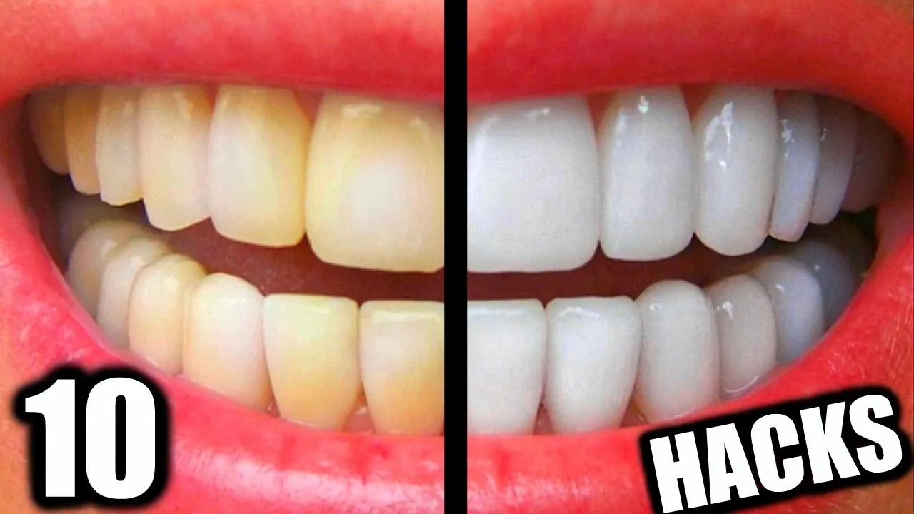 25658 oil pulling