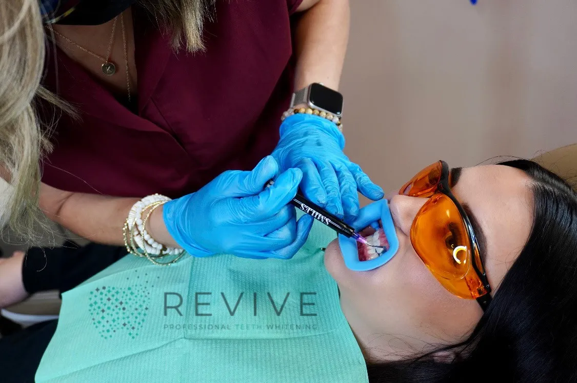 25659 in office teeth whitening