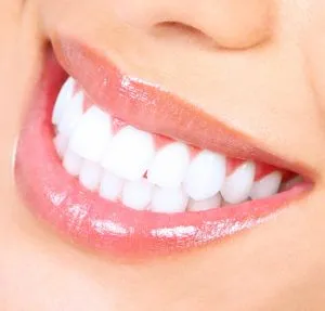 25659 take home teeth whitening