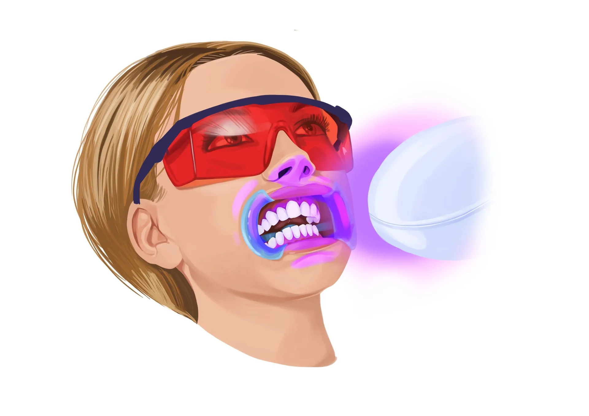 /img/25659-teeth-whitening-aftercare.webp