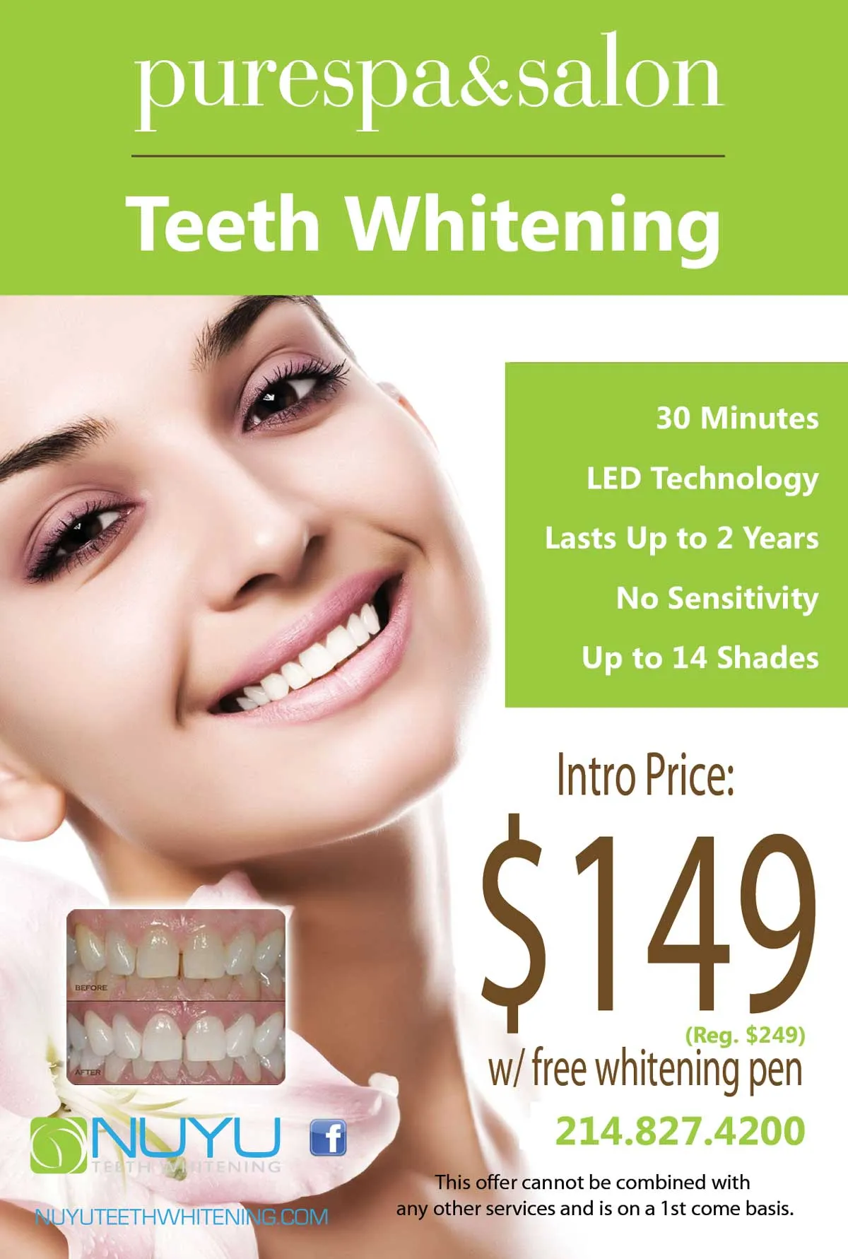 25659 teeth whitening houston overview