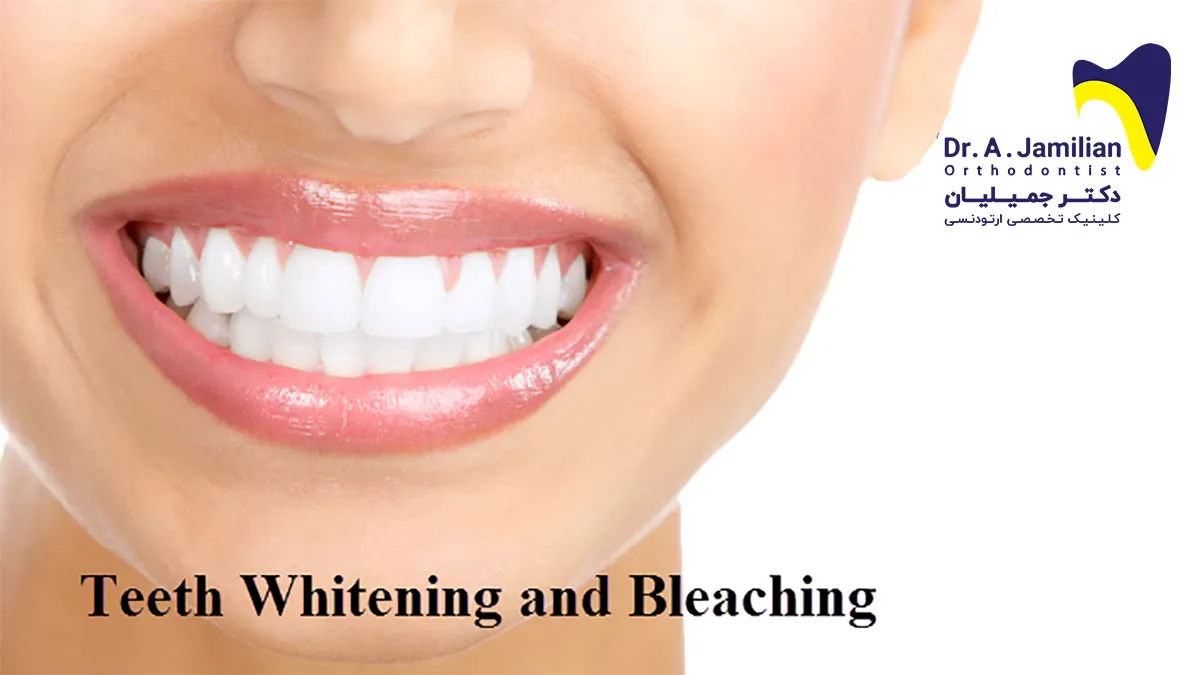 /img/25660-bright-smile.webp