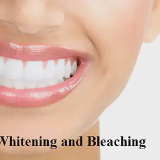 /img/25660-bright-smile.webp