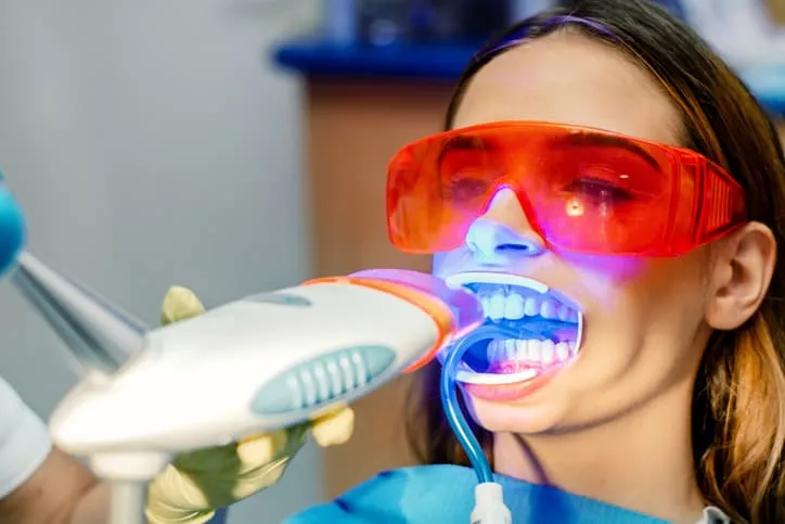 25660 professional teeth whitening