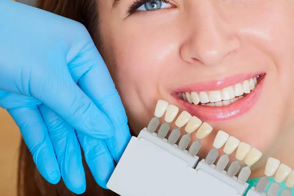 25664 benefits teeth whitening