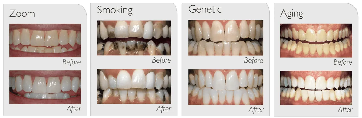 25667 oral health