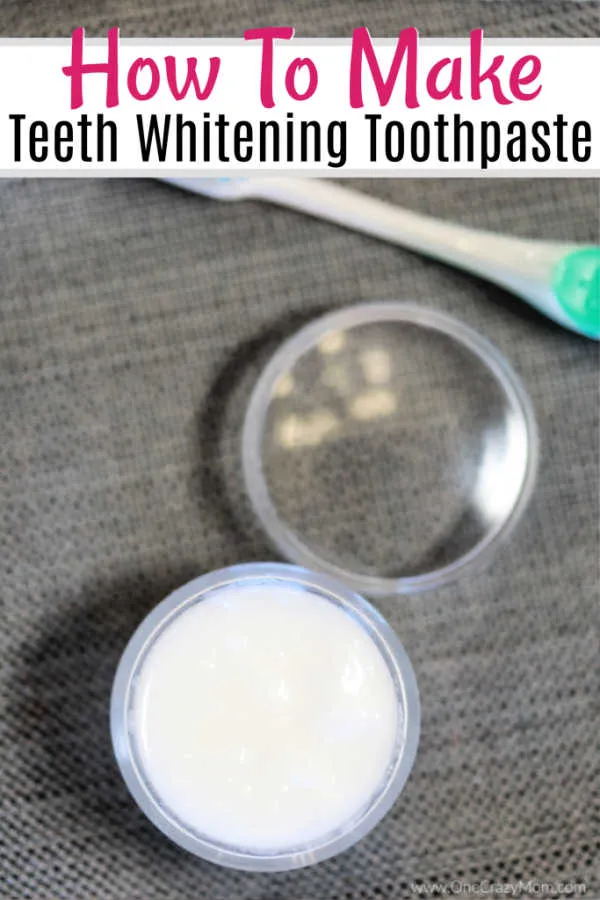 25673 braces teeth whitening tips