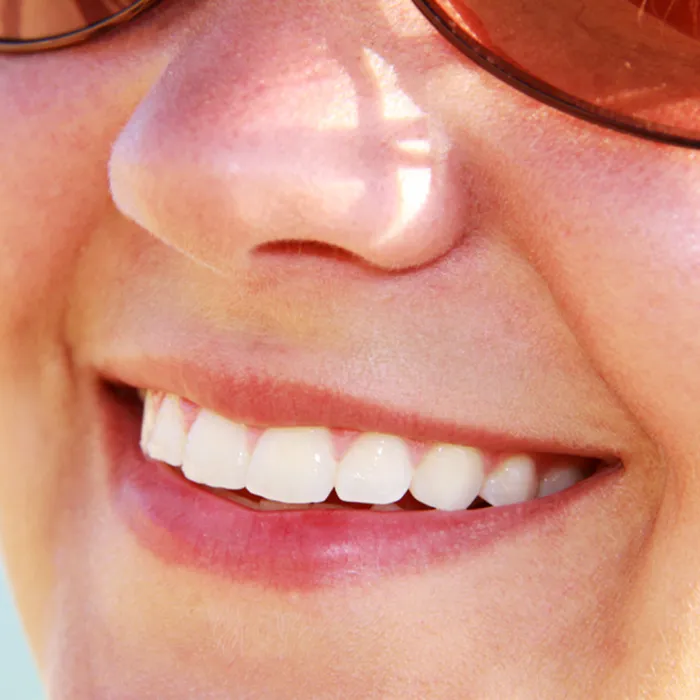 /img/25673-dentist-teeth-whitening.webp