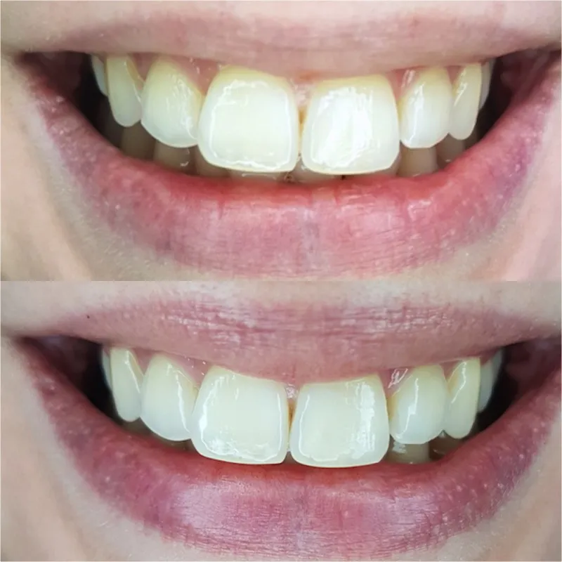 25678 healthy smile