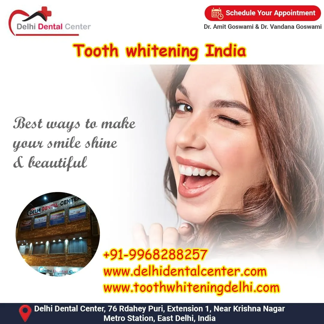 25679 teeth whitening alternatives