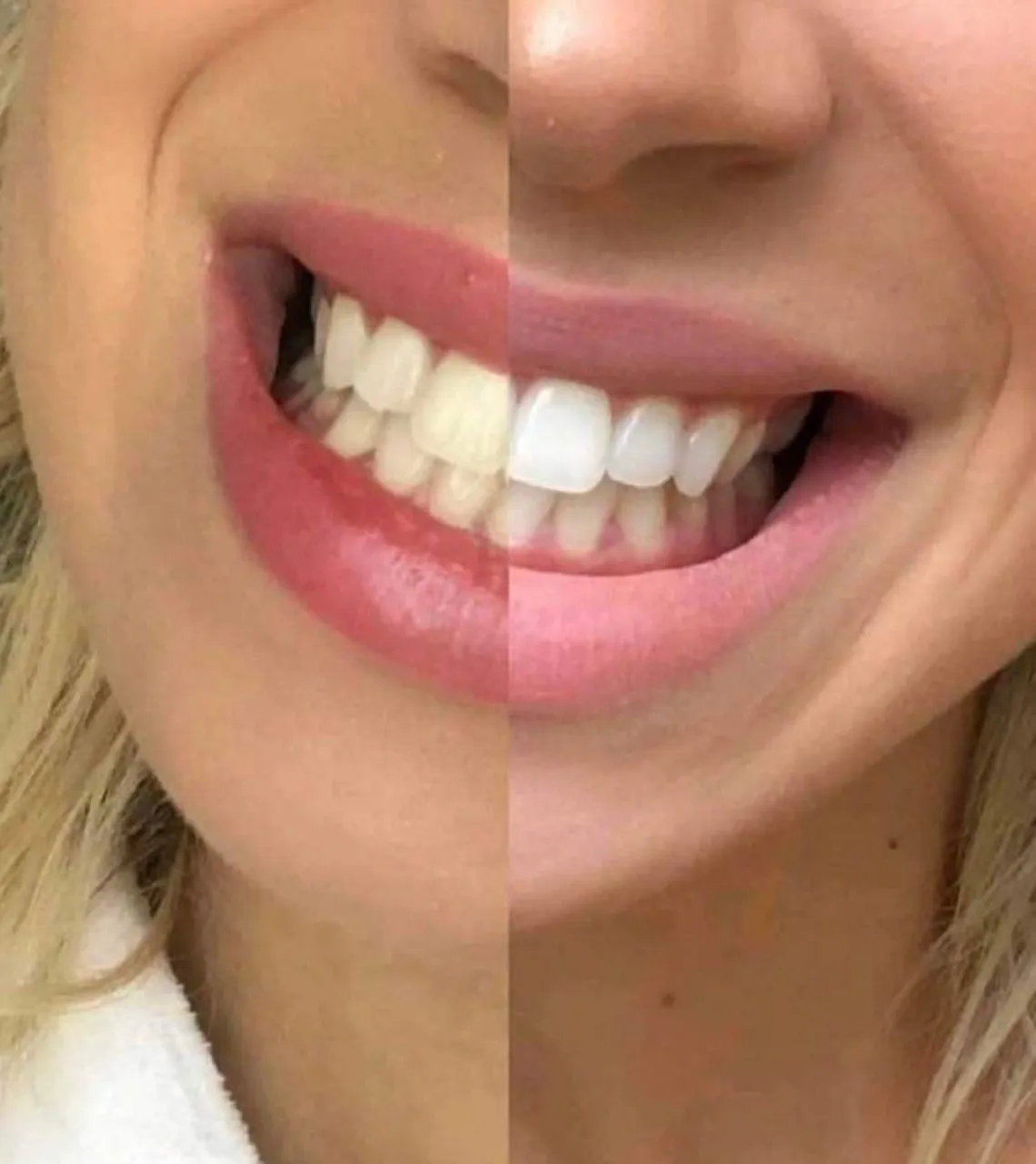 25689 crest strips testimonials