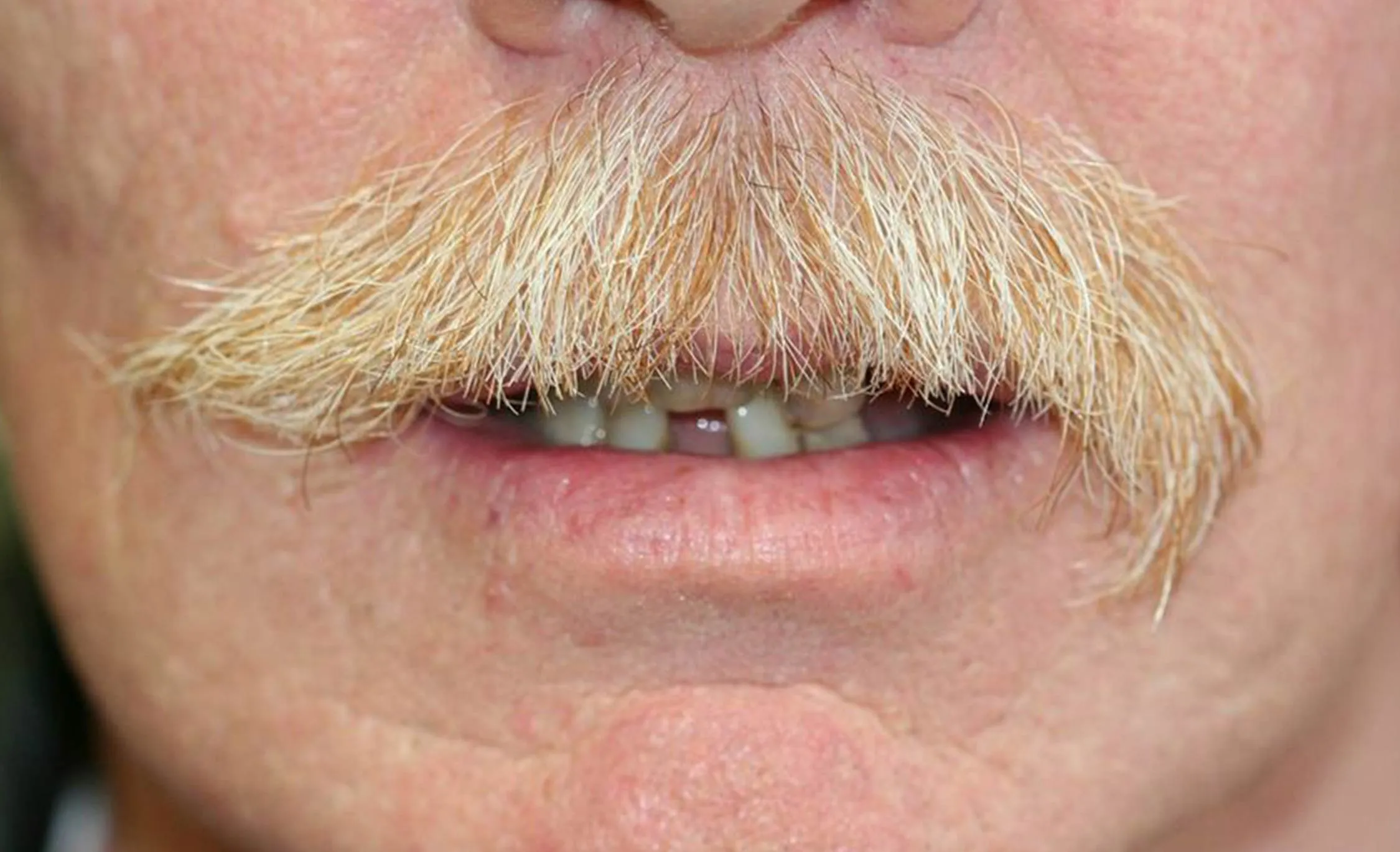 /img/25690-teeth-whitening-cost.webp