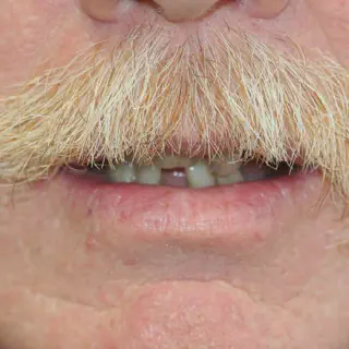 /img/25690-teeth-whitening-cost.webp
