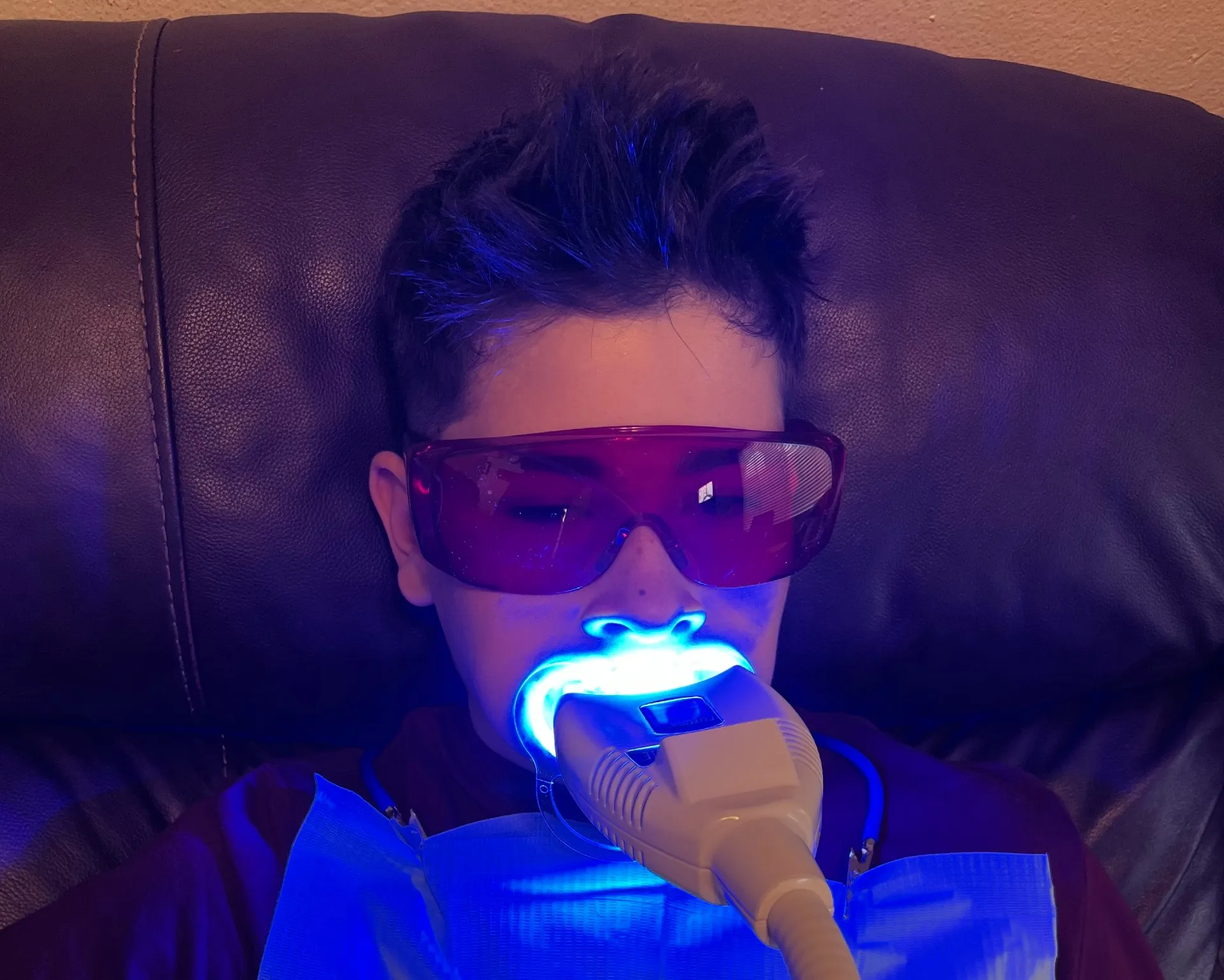 25691 in office teeth whitening tacoma
