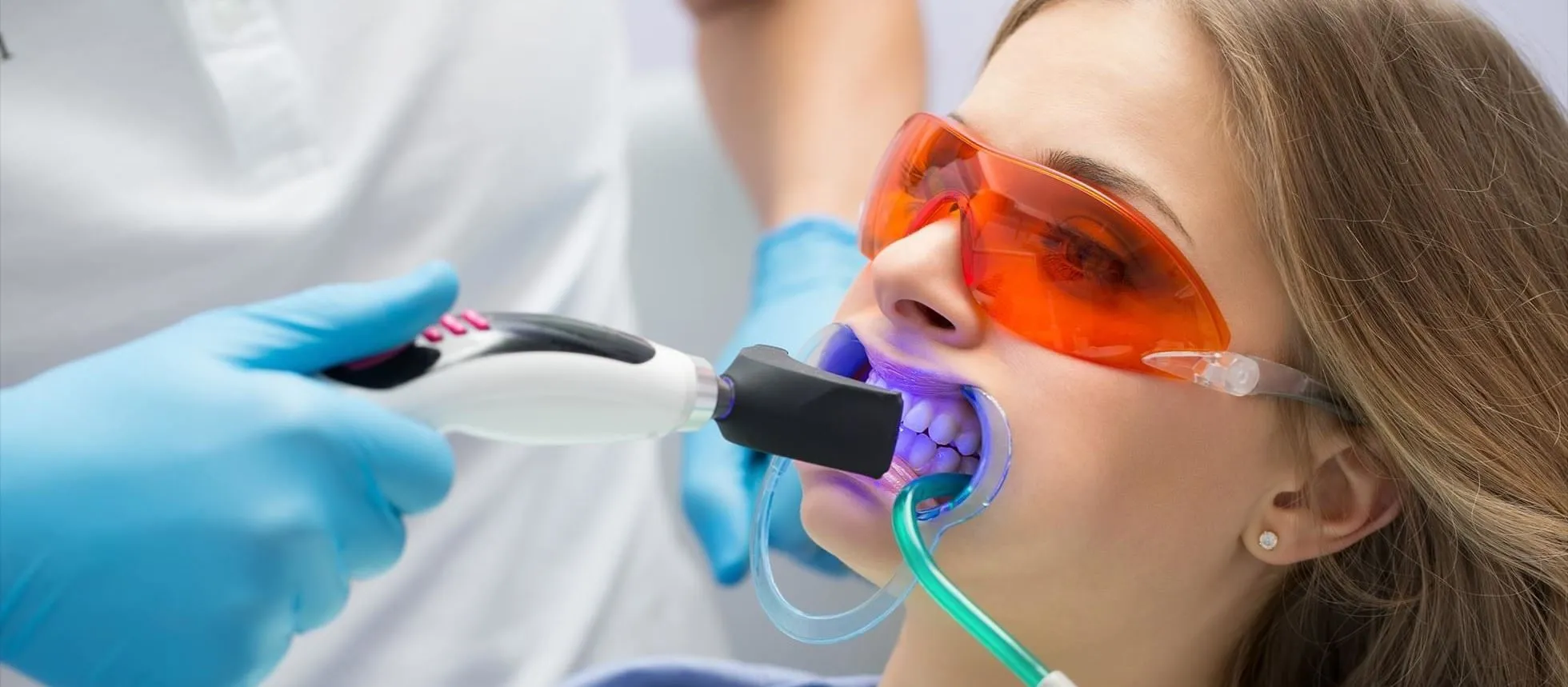 25691 teeth whitening science