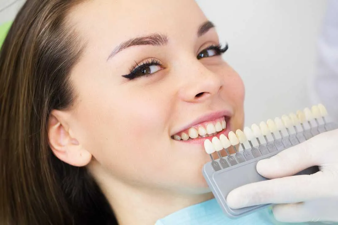25691 teeth whitening tacoma secret 2