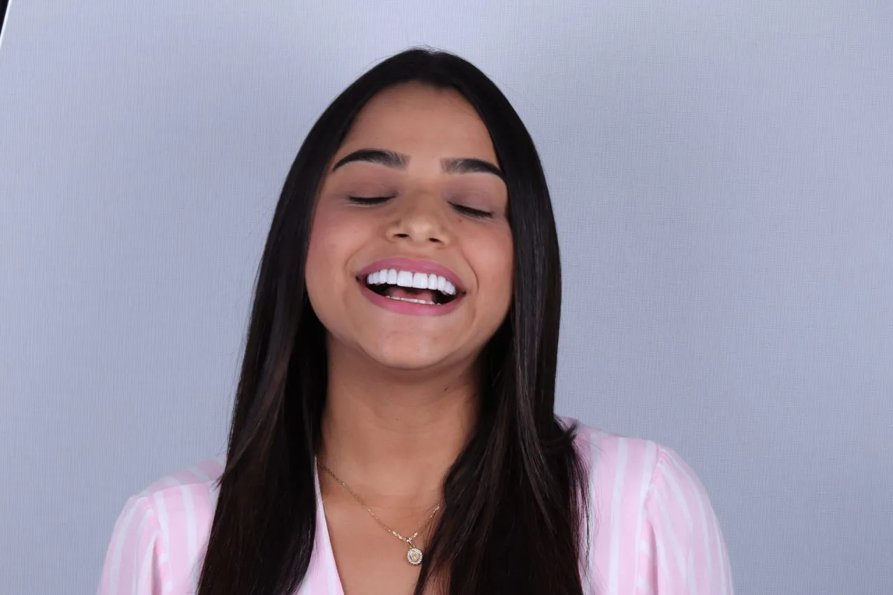 25695 teeth whitening appearance
