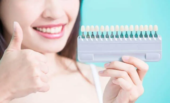 25699 dental whitening options