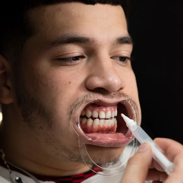 25700 teeth whitening odessa tx image2