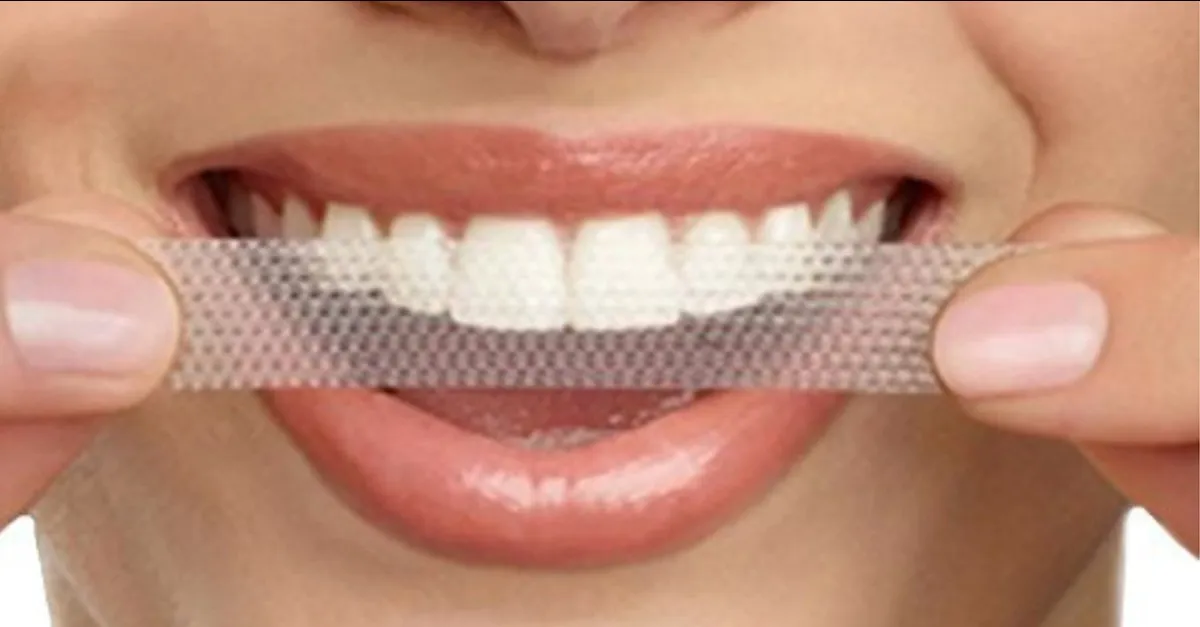 25702 teeth whitening strips overview