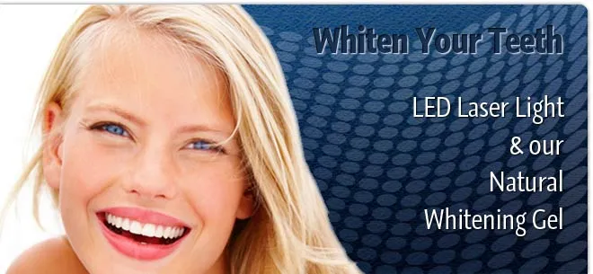 25704 teeth whitening application