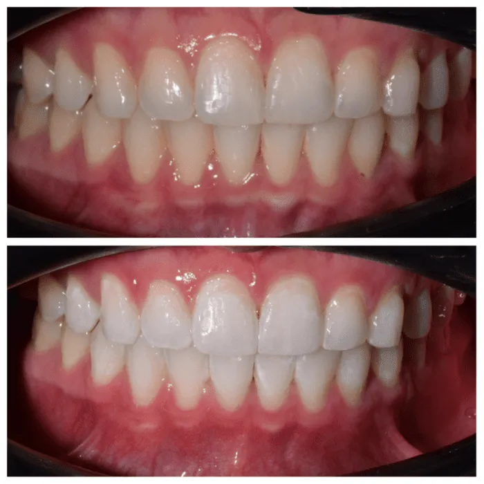 25706 avoid staining foods
