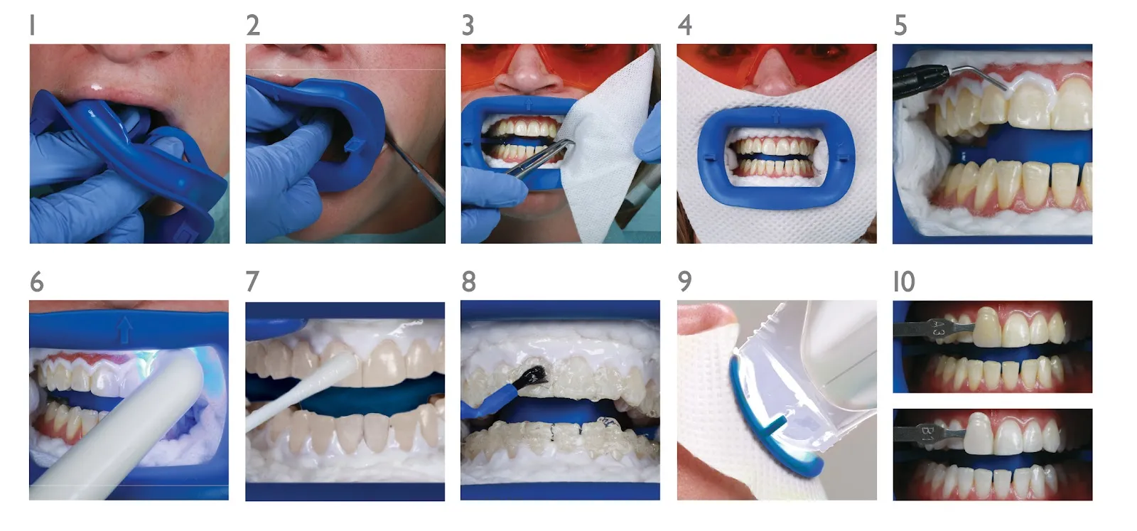 /img/25706-teeth-whitening-smile.webp