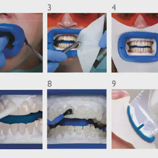 /img/25706-teeth-whitening-smile.webp