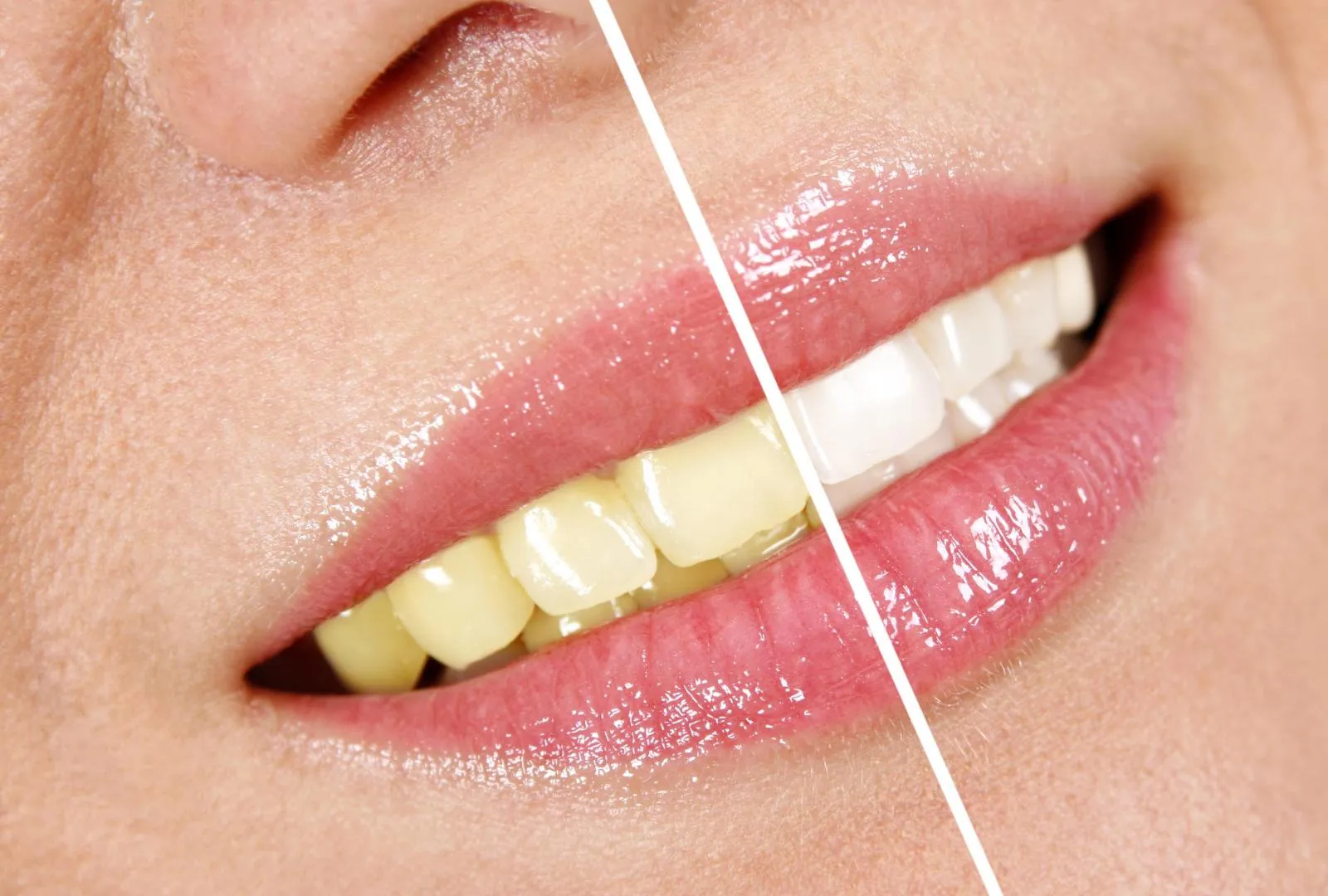 /img/25707-dental-checkup-marysville.webp